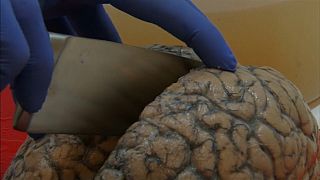 3000 دماغ بشري تحت تصرف أطباء مختصين في بلجيكا