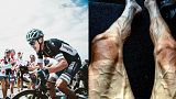 طواف فرنسا:الدراج البولندي بولجانسكي ينشر صورا مروعة لساقيه