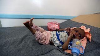 وباء الكوليرا يهدد 600 ألف يمني