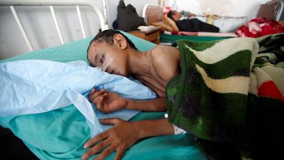 Yemen: 2 mln di bambini vittime di guerra, fame e colera