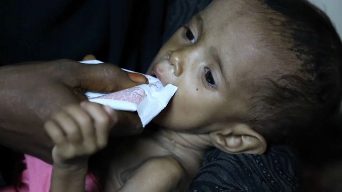 "Save The Children" alerta para epidemia de cólera no Iémen