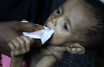 Cholera-Epidemie im Jemen bedroht mehr als eine Million Kinder