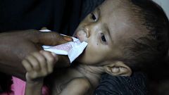 Cholera-Epidemie im Jemen bedroht mehr als eine Million Kinder