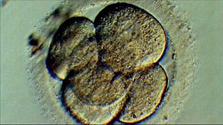 Forscher beheben Gendefekt bei Embryonen