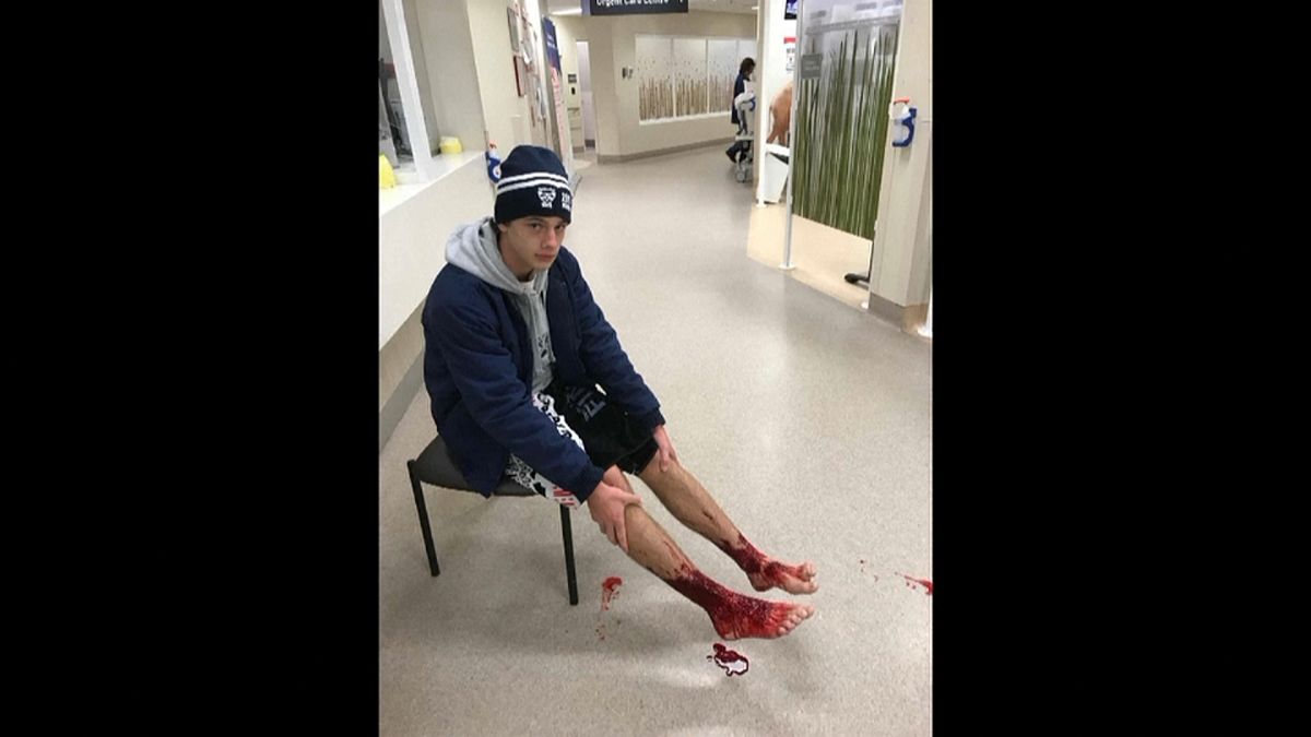 Australiano sai da praia com pés cheios de sangue após ataque misterioso