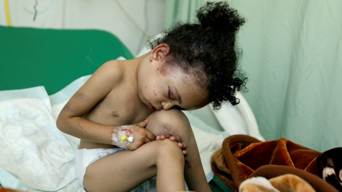 جنگ یمن؛ عکسهایی که عربستان نمی خواهد دیده شوند