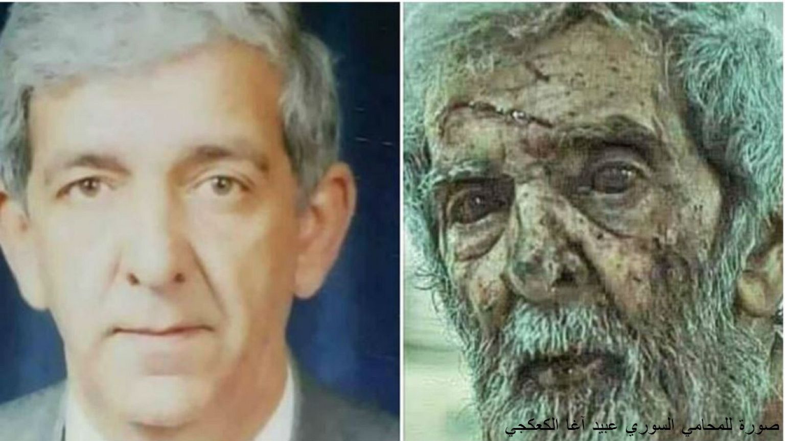 أثر الحرب السورية في وجه أحد مواطنيها... لمن هذه الصورة؟