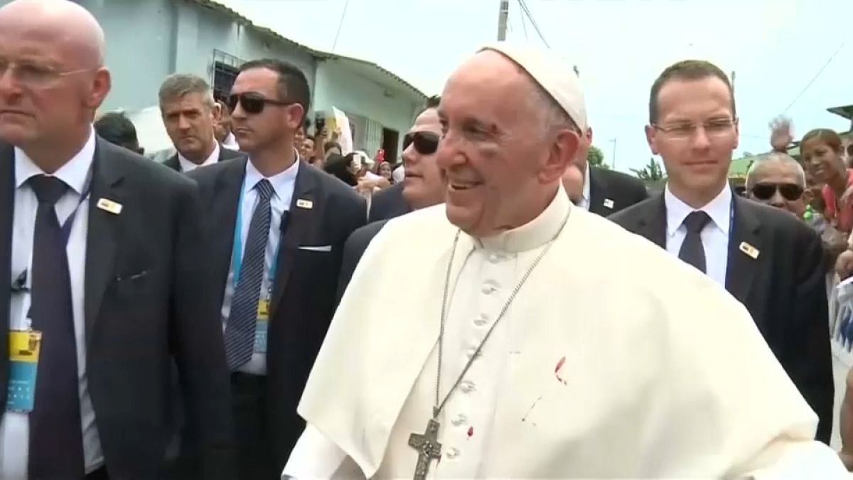 كدمة في وجه البابا لا تحول دون مواصلته الجولة في كولومبيا