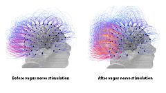Man in vegetative state for 15 years 'shows signs of consciousness' after pioneering therapy
