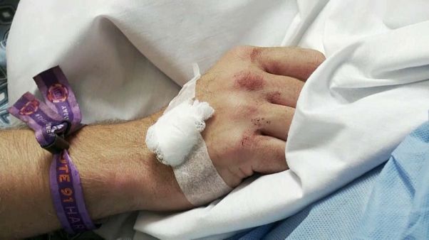 Strage Las Vegas, un testimone: ''Sinceramente pensavo che non ce l'avrei mai fatta'' Strage Las Vegas, un testimone: ''Sinceramente pensavo che non ce l'avrei mai fatta''