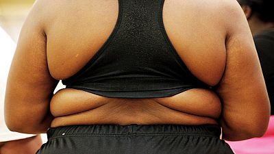 L'obésité, cette "épidémie" qui menace l'Afrique