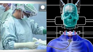 إجراء أول عملية جراحية لزرع الرأس في 2018