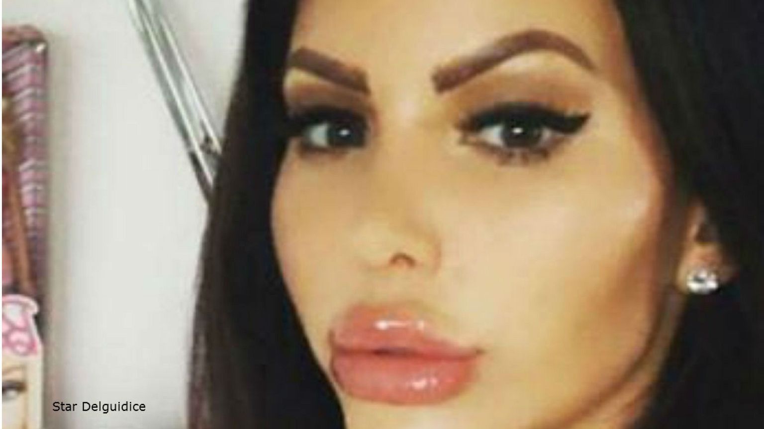 سيدة تنفق 220 ألف جنيه أسترليني للحصول على وجه باربي ومؤخرة جينيفر لوبيز!