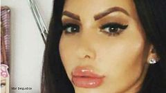 سيدة تنفق 220 ألف جنيه أسترليني للحصول على وجه باربي ومؤخرة جينيفر لوبيز!