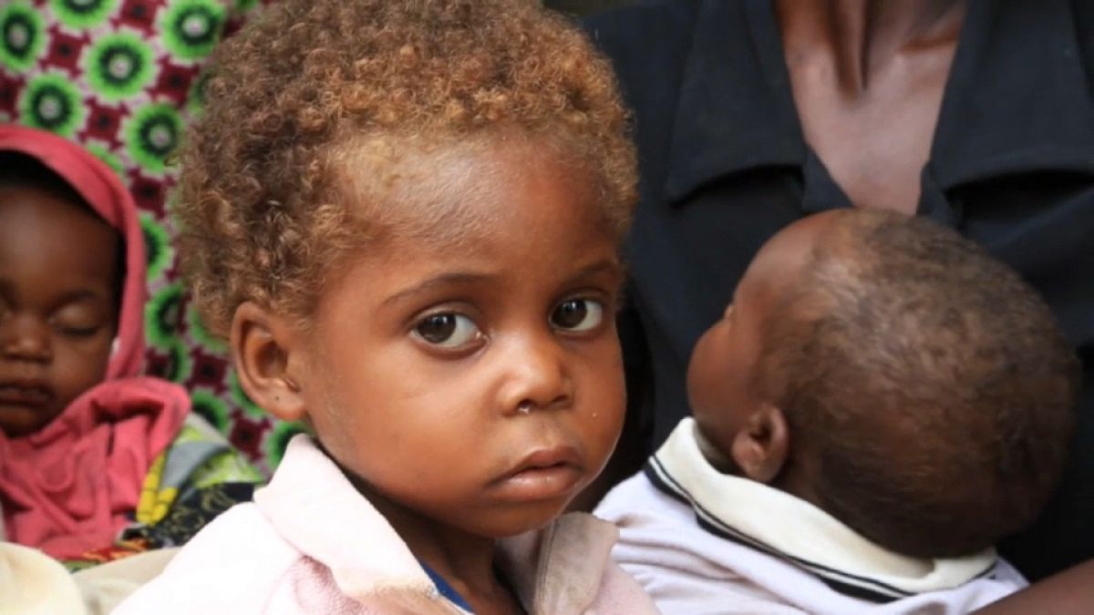BM'den Kongo'ya acil yardım çağrısı