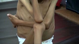 Vaga de fome no Iémen já fez milhares de vítimas