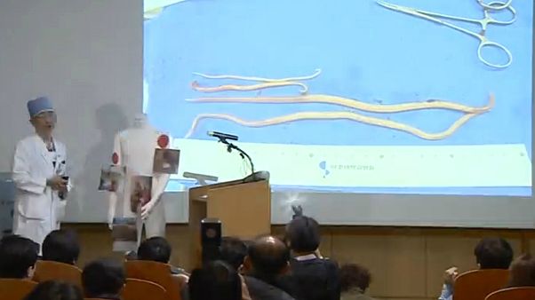 Il disertore nordcoreano ferito aveva parassiti di 27cm nel corpo Il disertore nordcoreano ferito aveva parassiti di 27cm nel corpo
