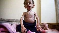 يأكلون القمامة ويفقدون الوعي من شدة الجوع.. أهلا بك في الغوطة الشرقية