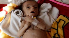 اليونيسيف: المساعدات التي وصلت نقطة في بحر.. فلا تحرمونا من مساعدة أطفال اليمن