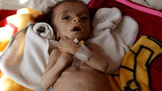 اليونيسيف: المساعدات التي وصلت نقطة في بحر.. فلا تحرمونا من مساعدة أطفال اليمن