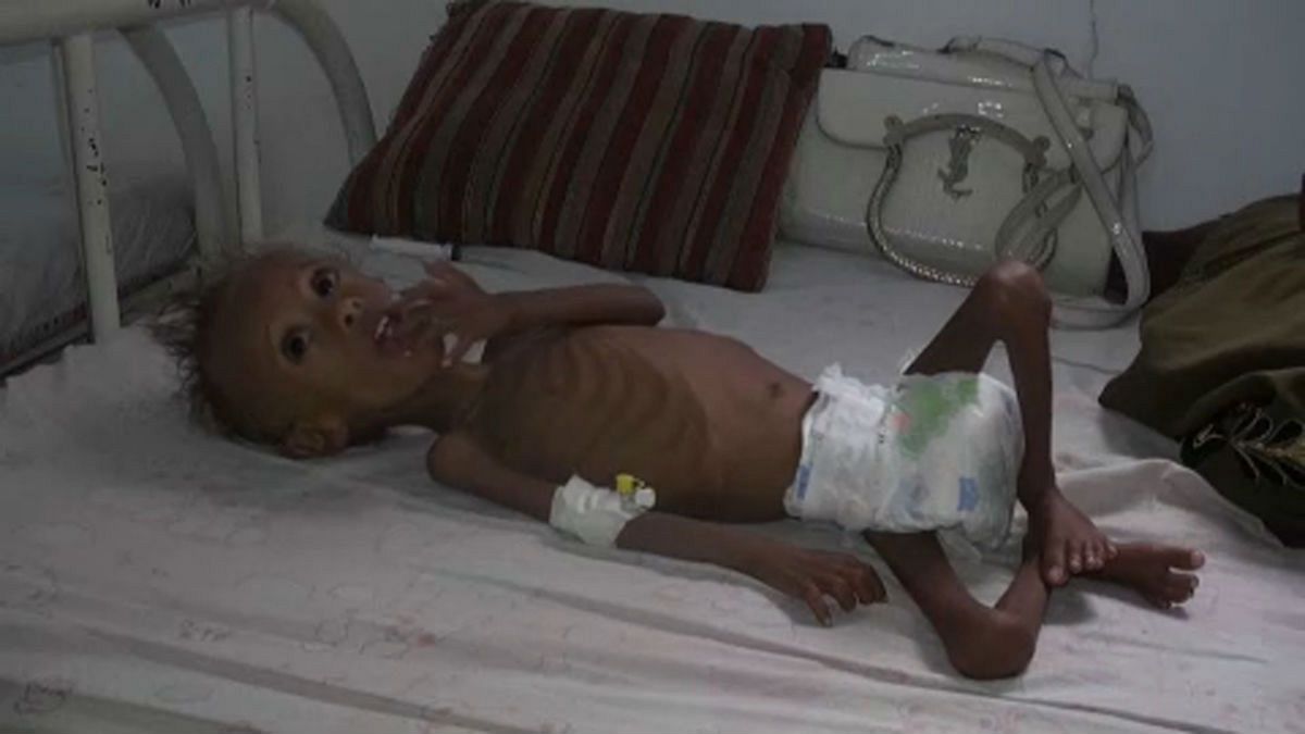 Éhezés és blokád Jemenben