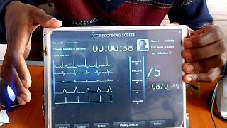 Cameroun : expérimentation d'une tablette pour des examens cardiologiques