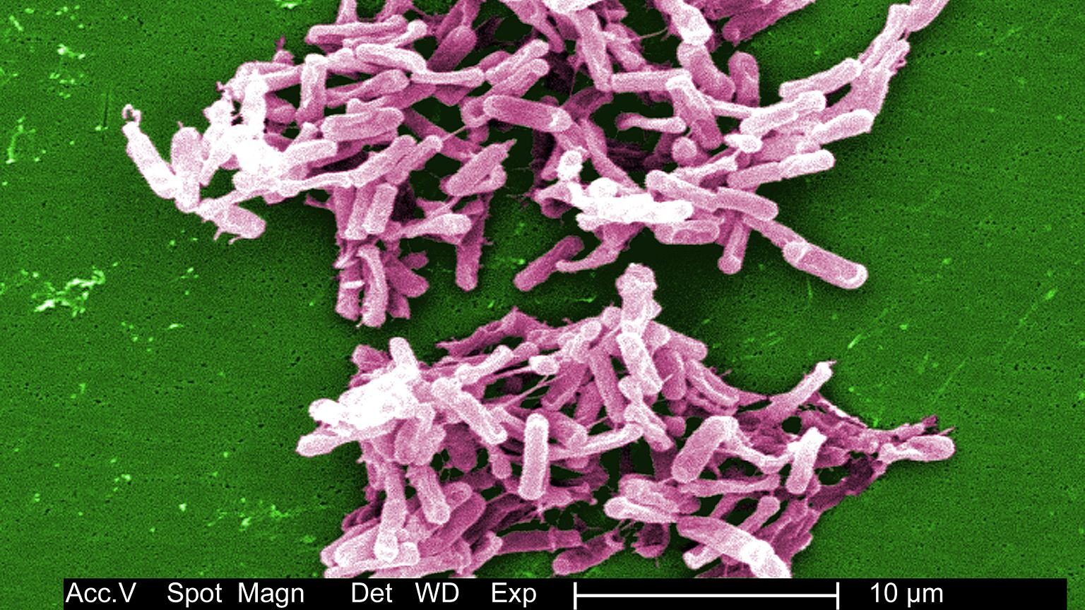 Antibiotics are losing their power against deadly infections. Can we fix the problem?