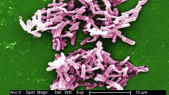 Antibiotics are losing their power against deadly infections. Can we fix the problem?