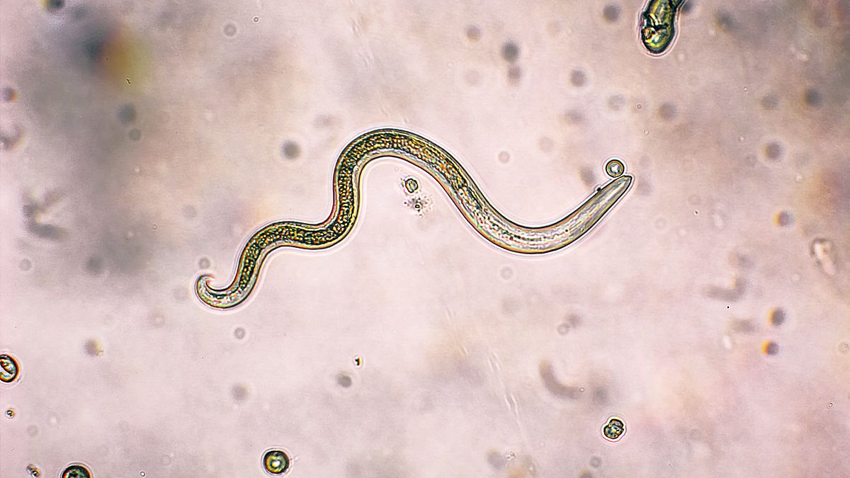 Image: A roundworm that causes Toxocariasis under a microscope.