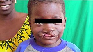 Nigeria : le tragique sort des « mauvais » bébés