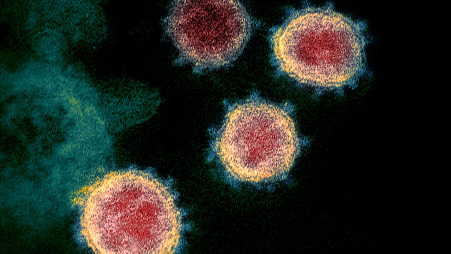 Image: coronavirus