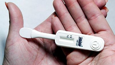 Rwanda to allow pharmacies sell oral HIV self-testing kits