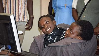 Tanzanians pay last respects to conjoined twins