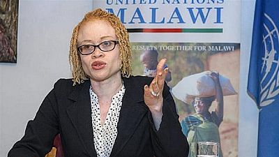 Malawi to field six candidates with albinism in upcoming elections to tackle stigma