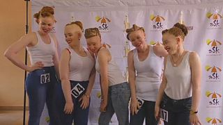 First-ever albinism contest held in Uganda