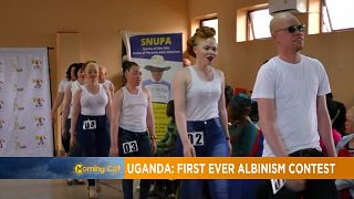 Beauty pageant for Albinos hold in Uganda [The Morning Call]