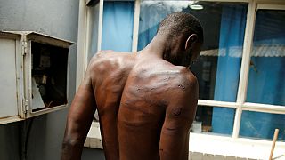 Zimbabwe : l'armée épinglée pour des "tortures systématiques"