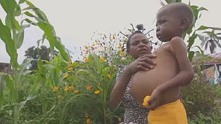 RDC : plus de 260 000 enfants malnutris dans le Kasaï