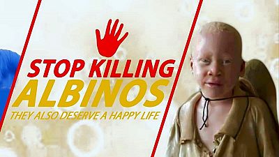 Malawi sentences man to death for killing an albino teenager