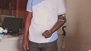 Nigerian start-up creates 3-D printed limbs for amputees