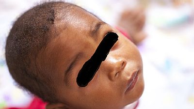 Ouganda : le virus du Sida injecté à un bébé ?