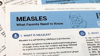 Measles in all 26 DRC provinces, 2019 death toll at 5,000 - WHO