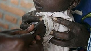Over 6,000 Congolese killed by measles outbreak - WHO