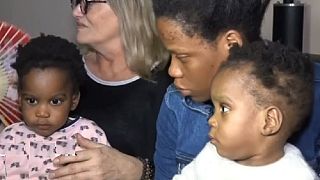 Year-old Cameroonian twins return home after separation surgery in France