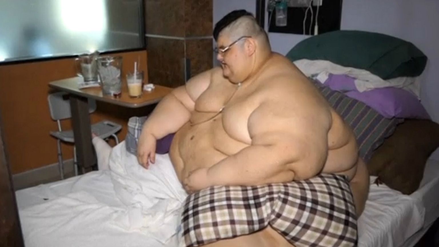 Mexico's 'heaviest man' has surgery to halve his weight