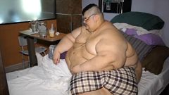 Mexico's 'heaviest man' has surgery to halve his weight