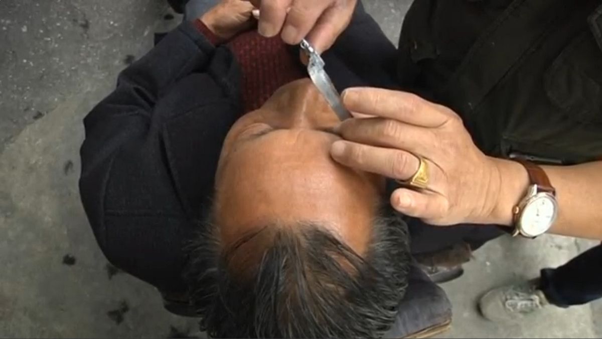 'Eye shaving': a traditional practice in China