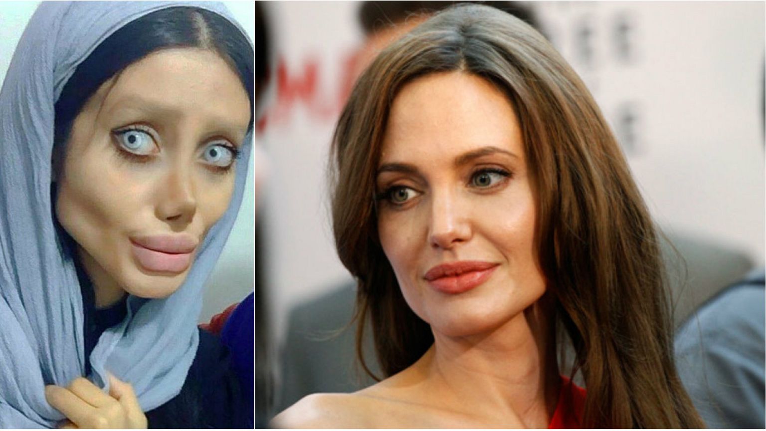 شابة إيرانية تجري عمليات تجميل لتشبه الممثلة الأميركية أنجلينا جولي