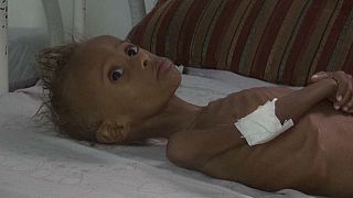 Millions could die in Yemen if blockade is not completely lifted