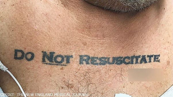 Patient's 'do not resuscitate' chest tattoo presents ethical dilemma for doctors Patient's 'do not resuscitate' chest tattoo presents ethical dilemma for doctors